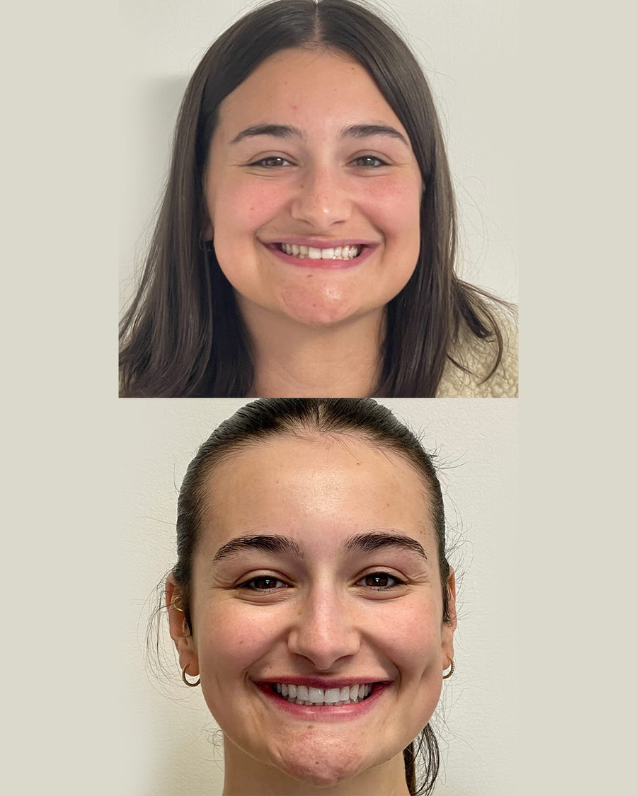 UGC before/after