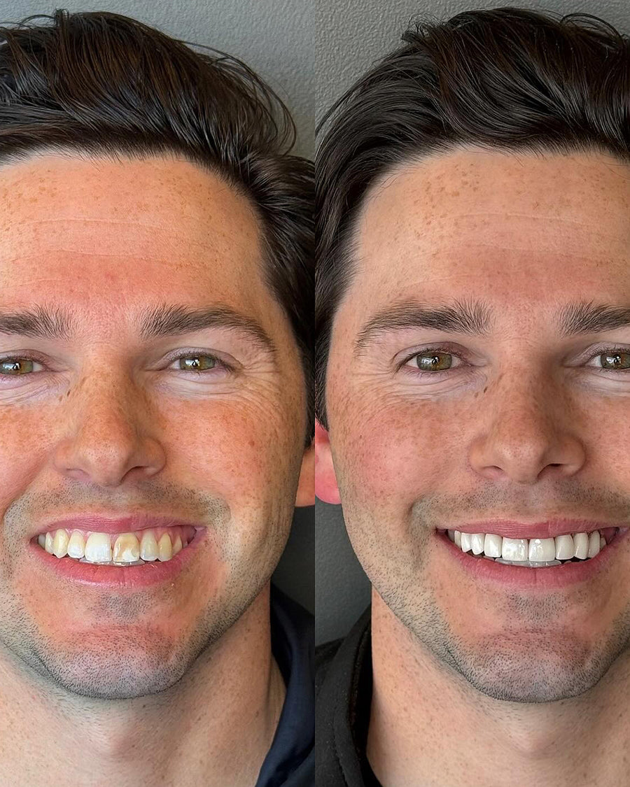 UGC before/after