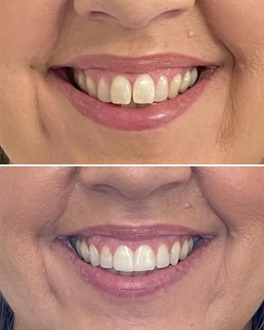 UGC before/after