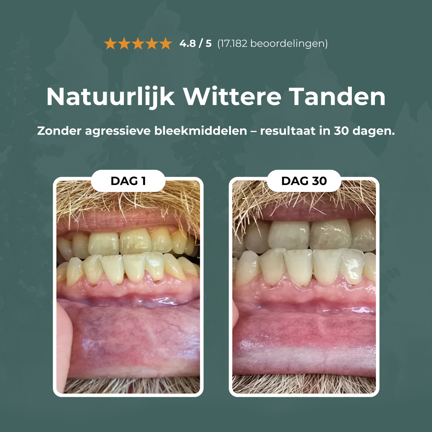 Healthy Gum – Voor een Stralende, Gezonde Glimlach