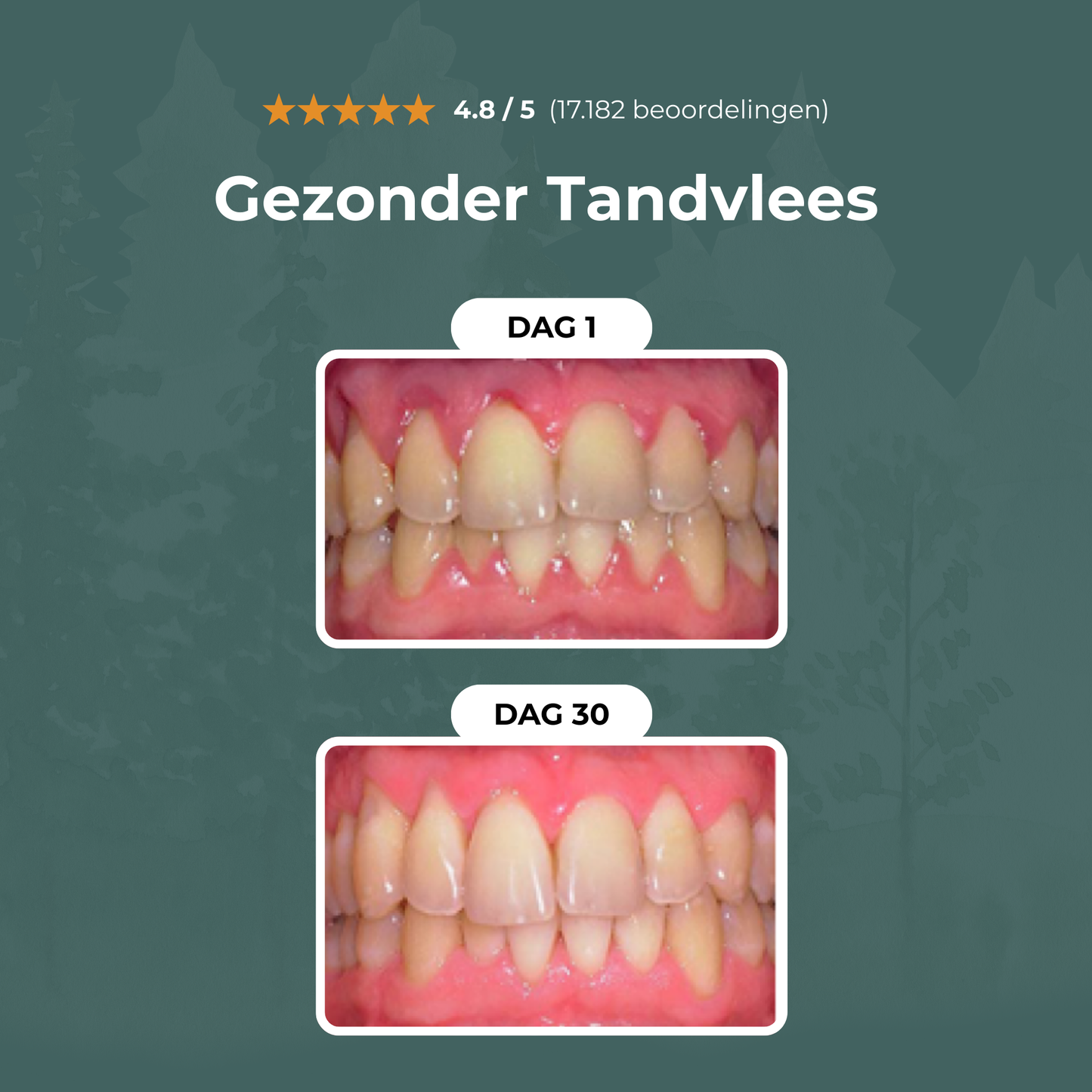 Healthy Gum – Voor een Stralende, Gezonde Glimlach