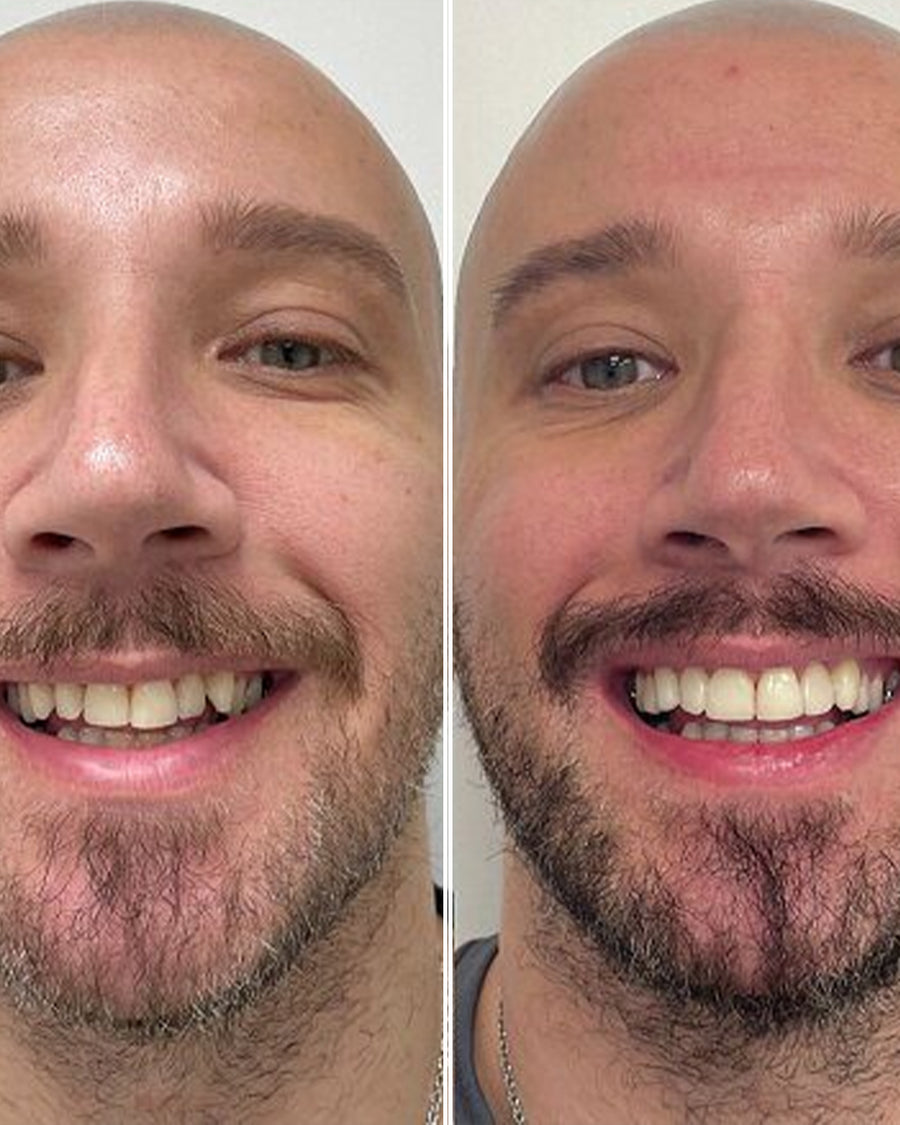 UGC before/after