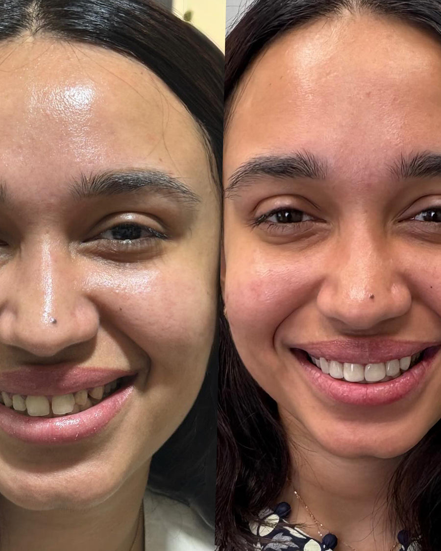 UGC before/after