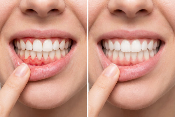 100% NATURAL — No Plastic. No Chemicals. No Dentist Required.